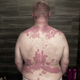 Illustration for article titled Dr. Pimple Popper Removes 68 Lipomas from One Person in Season 2 Premiere